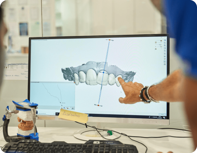 Person pointing at a 3D dental model on a computer screen, with dental tools and a dental mold visible on the desk.